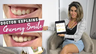 How to Correct A Gummy Smile | Doctor Explains the Options 😀 💉