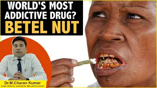 World's Most Addictive Drug | Adverse Health Effects Of Chewing Betel Nut | Eledent Dental Hospitals