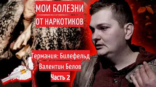 МОИ БОЛЕЗНИ ОТ НАРКОТИНКОВ 🌇 Валентин Белов | Германия Билефельд 2