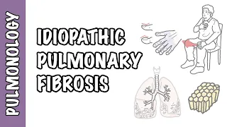 Idiopathic Pulmonary Fibrosis - pathophysiology, signs and symptoms, investigation and treatment