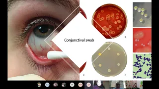 Lecture 2  Conjunctiva, Cornea   Sclera Part I