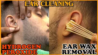 ASMR Dirtiest Ear Cleaning and Wax Removal by REIKI MASTER💈#asmr
