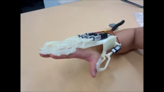 Robotic Finger Orthosis