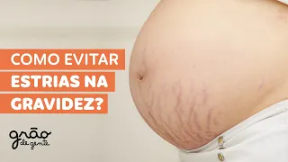 O QUE VOCÊ PRECISA SABER SOBRE ESTRIAS NA GRAVIDEZ