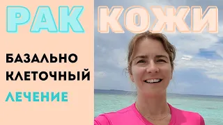 Рак кожи базальноклеточный.  Базалиома "не меланома" Факторы риска Симптомы.  Диагностика. Лечение