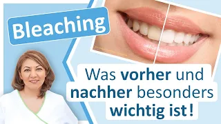 Bleaching: Was ist vor und nach der Zahnaufhellung besonders zu beachten? Zahnarzt Großostheim