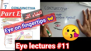 Eye lectures #11. #Ptergium fibrovasular connective tissue of conjunctiva. #conjunctivitis #eye