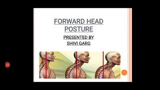 FORWARD HEAD POSTURE by Enthusiast: SHIVI GARG - E-MM Live Streaming Event 2020