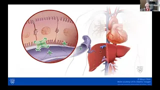 ASG ATTR Amyloidosis Webinar July 15, 2023