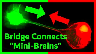 Brain Organoids Communicate: A Step Toward "Organoid Intelligence"