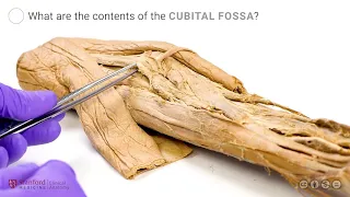 Anatomy of the Upper Limb: Cubital Fossa and Flexors of the Forearm