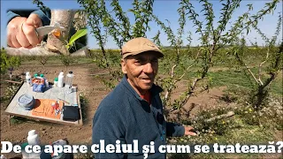 De ce apare cleiul și cum se tratează?