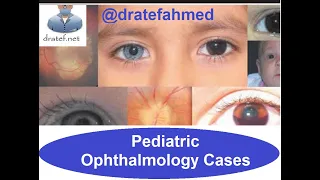 Pediatric Ophthalmology Cases/ Case Presentation / Medical Case Study   Case/ Discussion Case Report