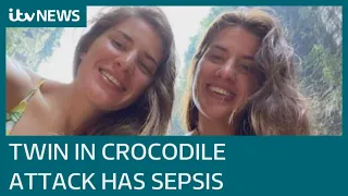 British woman in coma after twin fights off crocodile in Mexico now has sepsis | ITV News