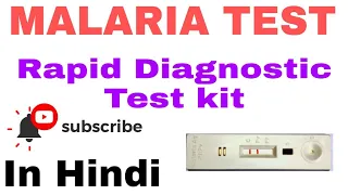 Rapid Diagnostic Test for Malaria