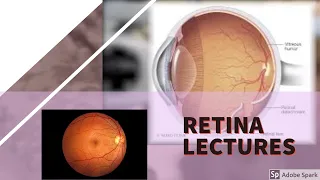 RETINA LECTURE 6 DIABETIC RETINOPATHY in detail with all important stuff