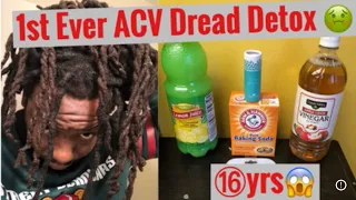 1st Ever ACV Dread Detox 🤢🤮| By: @frizzy2fresh