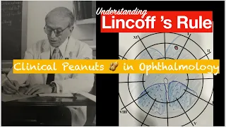 Clinical Peanuts 🥜 -  Understanding Lincoff’s rule for localising break in a primary RD