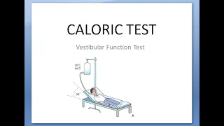 ENT EAR Caloric Test BrainStem Death dead check VestibuloOcularReflex COWS Nystagmus Cold Hot Water