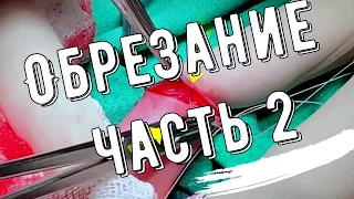 Обрезание. Часть 2