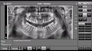 EZDent i, Chapter 02 01   Acquisiton Vatech 2D and 3D FINAL