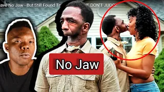 BORN WITHOUT A JAW But Still FOUND LOVE | Love Dont Judge No Jaw | Reaction video