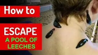 HOW TO ESCAPE A POOL OF LEECHES