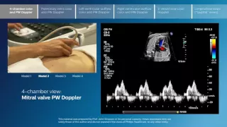 Advanced screening views of the fetal heart - Part 1 - 4-chamber color and PW Doppler