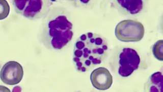 Cell apoptosis