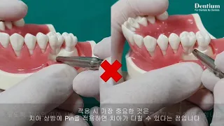 How to use Dentium Membrane Fixation Pin 사용방법 영상