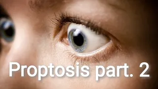 Orbit | Proptosis (Diagnosis and Treatment)... Part. 3