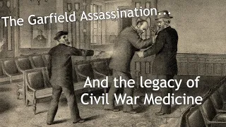 How Civil War Medicine Killed President James Garfield