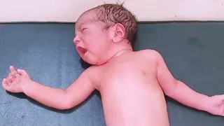 Newborn baby neck? | Newborn baby video | cute babies | History Creator Medics