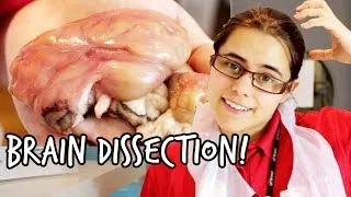 What's inside a brain? | Brain Dissection | We The Curious