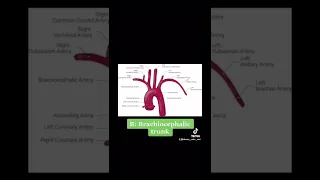 Anatomy hack: Memorise the major branches of the arch of aorta! (Mnemonic)