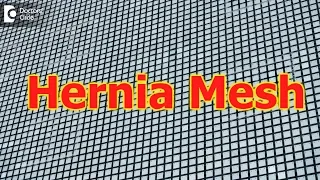 How long does hernia mesh last ?How long does it take for mesh to heal? - Dr. Nanda Rajaneesh