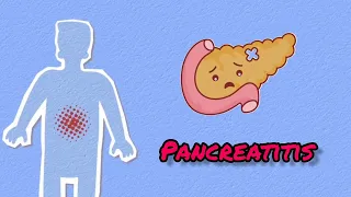 Pancreatitis क्या है समस्या  ? || OVER VIEW OF PANCREATITIS || Pancreatitis in Hindi ||