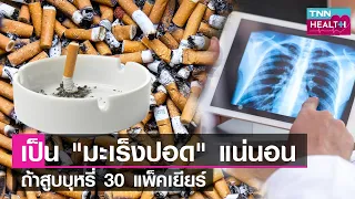 สูบบุหรี่ 30 แพ็คเยียร์ เสี่ยงเป็นโรคมะเร็งปอด แน่นอน l TNN HEALTH l 27 05 66