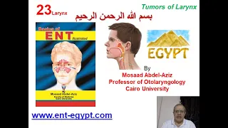 Larynx 3 (Mosaad Abdel-Aziz): Tumors of Larynx