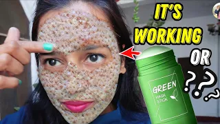 Green Mask Stick || Does This Green Mask Work?? I Tried Green Mask And Shocked 😳 || Viral Video