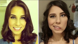 Beauty queen goes through long surgery at UCSF after stroke partially paralyzes her face