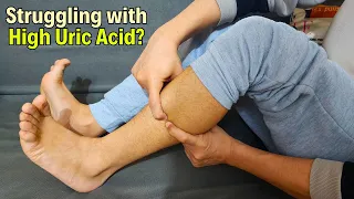 High Uric Acid? Lower Uric Acid FAST! Mind BLOWN!