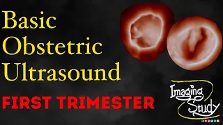 Basic Obstetric Ultrasound: First Trimester Pregnancy