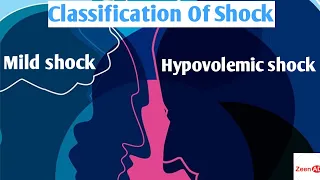 Classification Of Shock|Hypovolemic Shock And Its Management|Mild Shock|Moderate Shock|Severe Shock