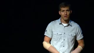 Finding a way to do more with less | Brad Hurtig | TEDxYearlingRoad