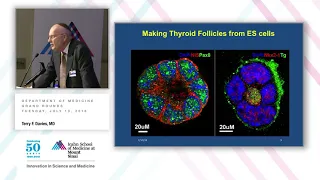 Pregnancy and Autoimmune Thyroid Disease