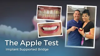 The Apple Test / Permanent Dental Implant Bridge/Teeth Tomorrow