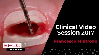 Francesco Mintrone / Clinical Video Session 2017