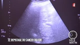 Santé - Le dépistage du cancer du foie - 2015/09/31