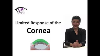 Limited Responses Of The Cornea